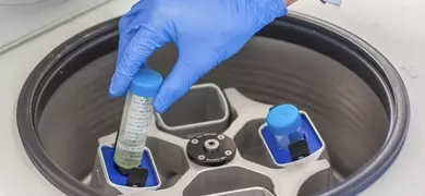 A gloved hand is placing a test tube into an open centrifuge machine with multiple slots. The lid of the centrifuge is raised, revealing the interior.