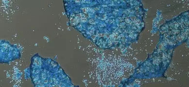 Cluster of blue, porous mesenchymal stem cells