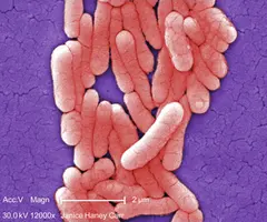 Pink rod-shaped salmonella bacteria clustered together.