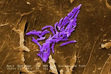 PHIL 11033_Mycobacterium fortuitum (skin infections - manicures and pedicures)_Janice Haney Carr (Credit).tiff