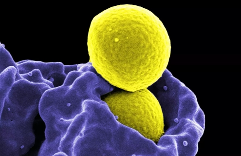 Yellow spheres of methicillin-resistant staphylococcus aureus.