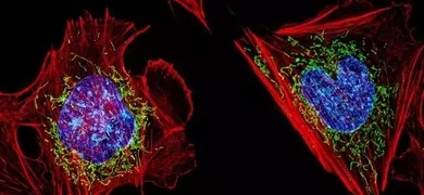 Spherical orbs of fluorescent red, blue, purple, and green mitochondria fibroblasts.