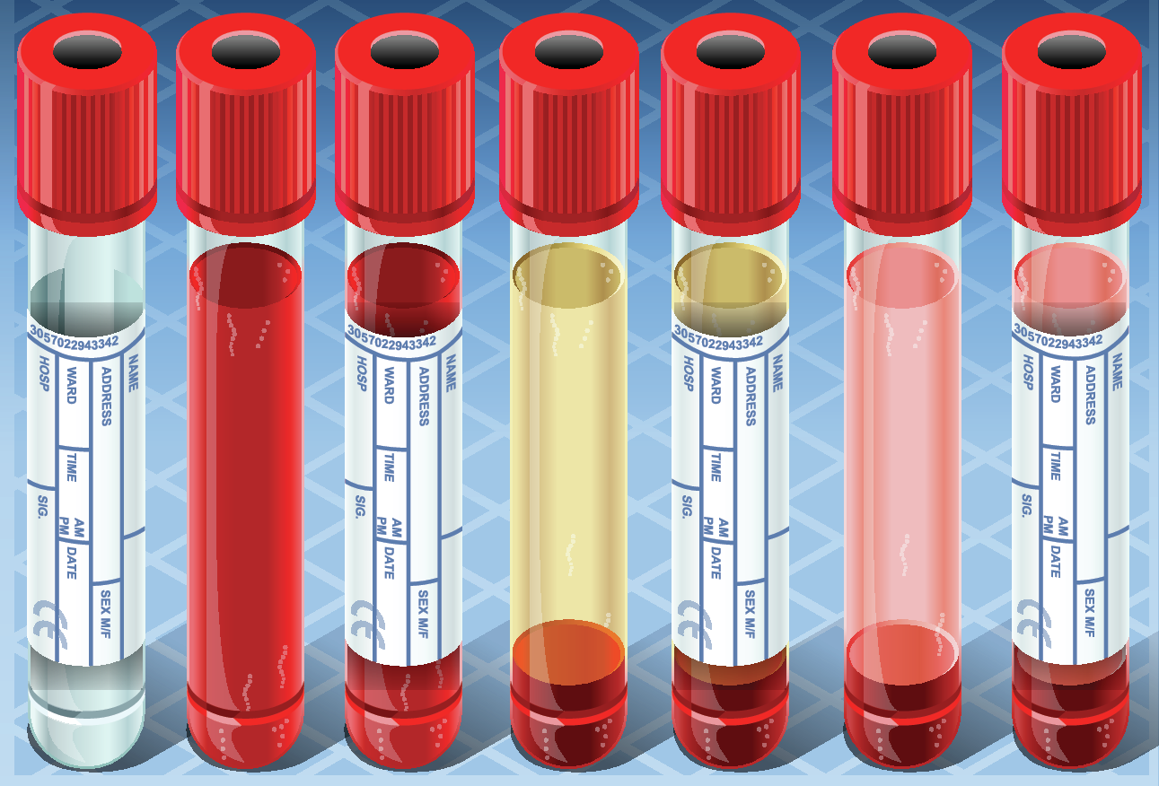 Illustration of six labeled test tubes with red caps, each containing different colored liquids. The colors of the liquids range from clear to various shades of red and yellow, indicating different types of samples or substances.