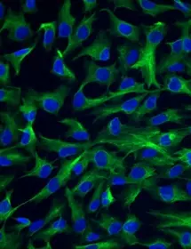 Green and blue epithelial htert cells.