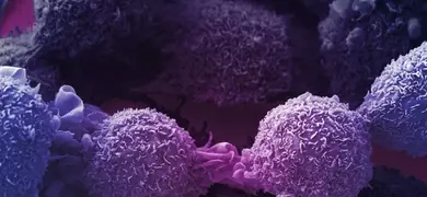 Round, textured, purple lung cancer cells on a dark background.