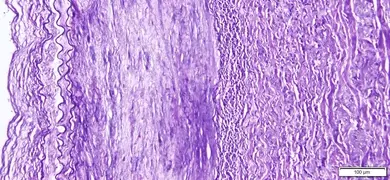 Purple elastic stain artery.