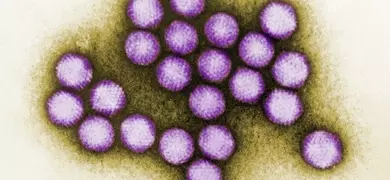 Purple and white spheres of adenovirus.