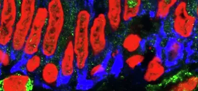 Red and blue Eschirichia coli bacteria.