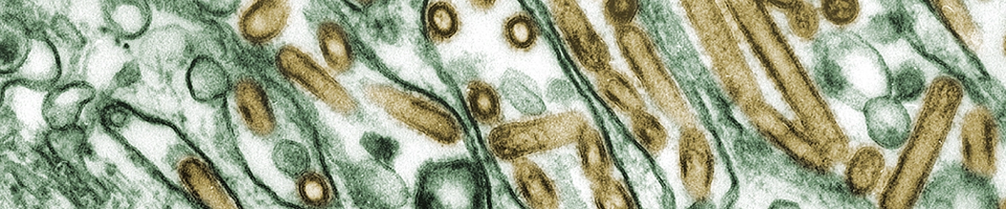 A digitally colorized transmission electron micrograph shows Avian Influenza A (H5N1) virus particles highlighted in gold within infected Madin‑Darby Canine Kidney (MDCK) epithelial cells shown in green. Numerous elongated and spherical virions are visible among cellular membranes, illustrating viral replication inside host cells.