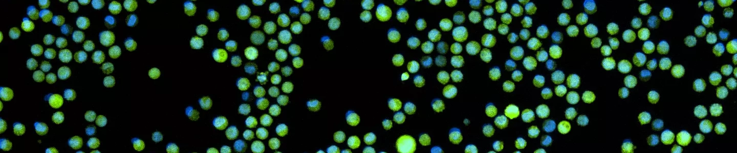 Green K562-GFP with nuclear stain.