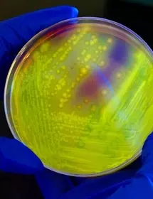 Blue-gloved hands holding a petri dish containing yellow clostridium difficile bacteria.