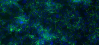 A microscopic image showing a dense network of colon cells stained with fluorescent dyes in shades of blue and green. A 100 micrometer scale bar is visible at the bottom right.