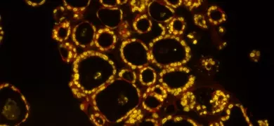 Microscopy image showing a cluster of spherical organoids with bright yellow outlines and black centers, set against a dark background.