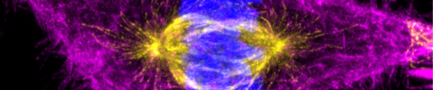 Super-resolution image of a fixed hTERT-RPE1 cell in mitosis, showing the interaction between actin (magenta) and microtubules (red). The image is displayed as a maximum intensity projection from NSPARC stacks.