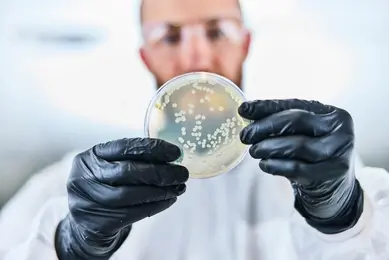 Yarrowia lipolytica A Versatile Non-Conventional Oleaginous Yeast for ...