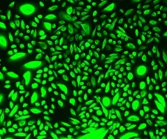 Green mammary epithelial cells.