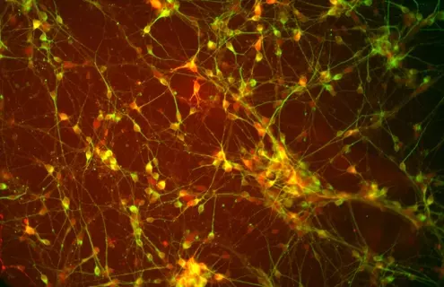 Green and red dopaminergic Diff Tuj1 DAPI cells.