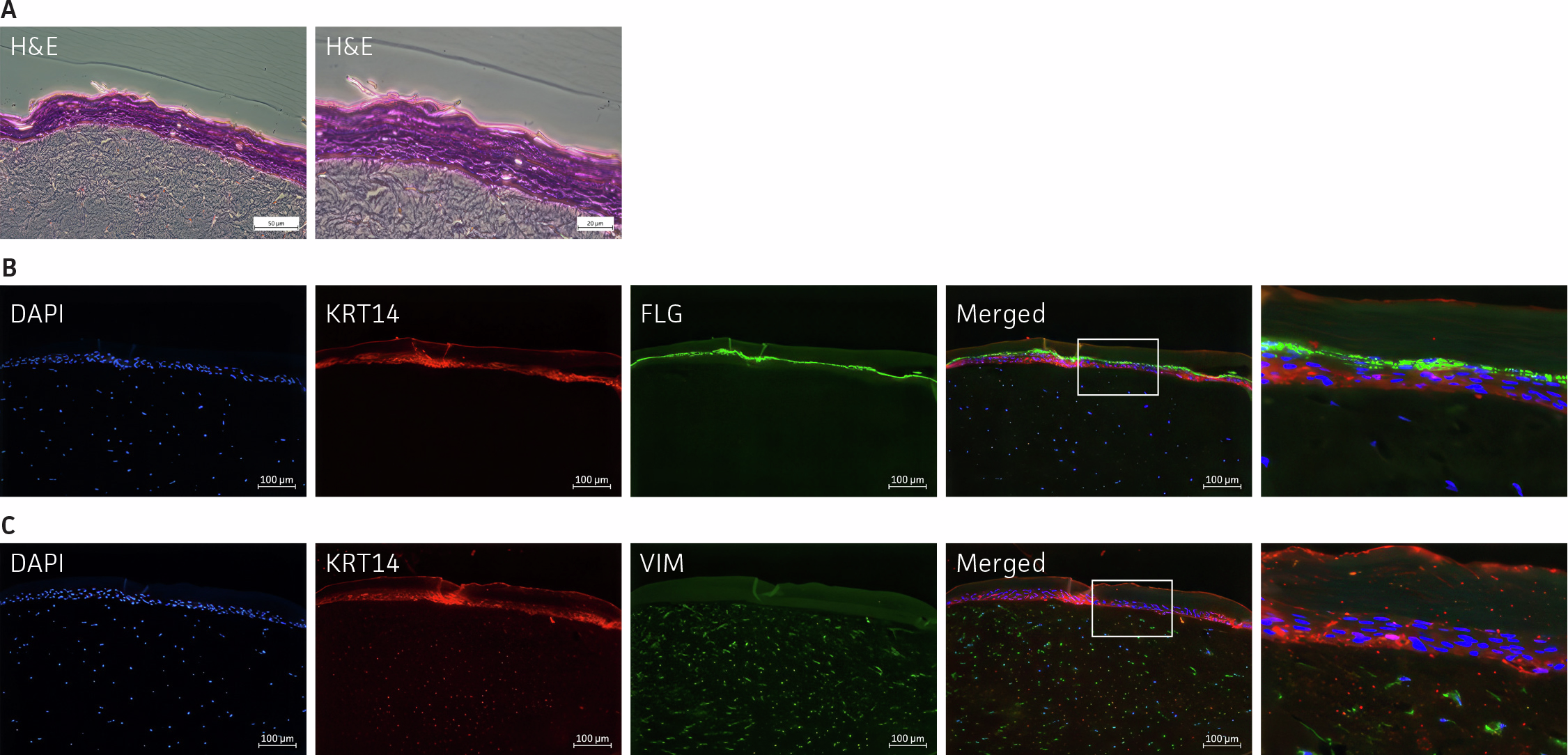 Histology and fluorescence images show a 3‑D skin model formed by coculturing immortalized keratinocytes with immortalized dermal fibroblasts, producing a stratified keratinocyte layer over a fibroblast‑rich collagen matrix. Immunofluorescence panels highlight marker expression, including KRT14 with either filaggrin or vimentin, confirming epidermal differentiation and the presence of dermal fibroblasts.