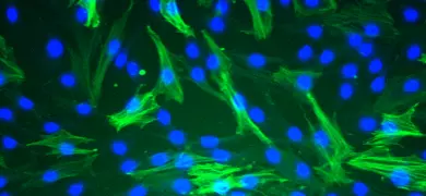 Fluorescent green and blue aortic smooth muscle cells.