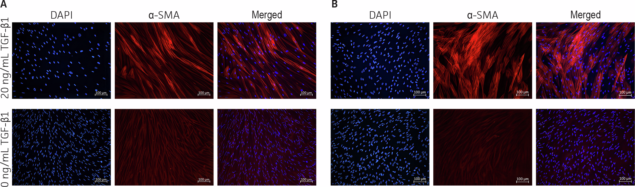 Fluorescence images show hTERT HDFa and primary HDFa cells treated with TGFβ1, which leads to strong α‑SMA staining indicating differentiation into myofibroblasts, while untreated control cells show minimal α‑SMA signal. Merged images display red α‑SMA fibers and blue DAPI‑stained nuclei, confirming TGFβ1‑dependent induction in both cell types.