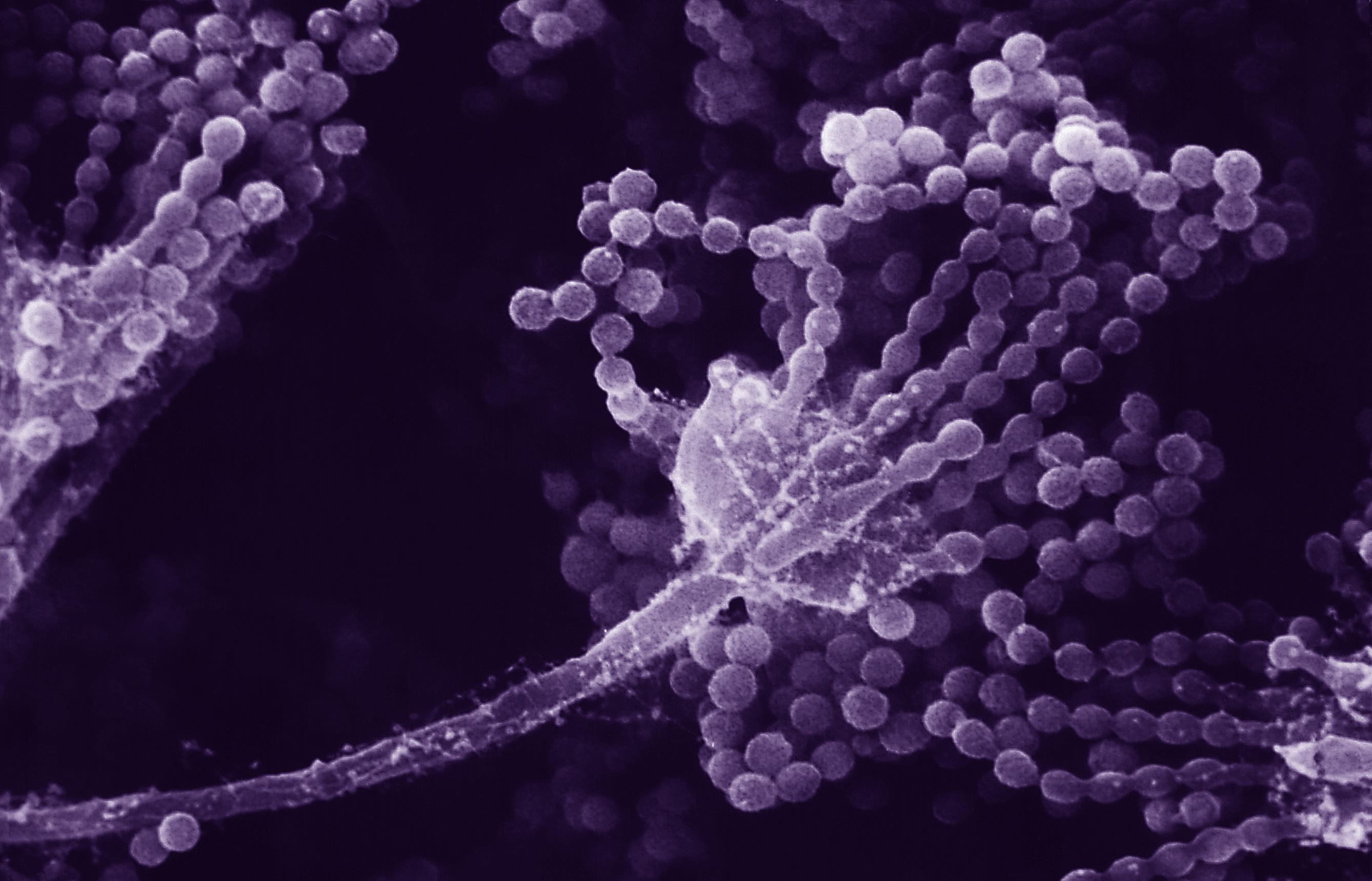 Purple strands of grape-like Aspergillosis fungus.