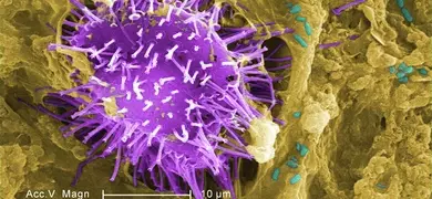 Colorized scanning electron microscope image at 2500X magnification shows a spiky microorganism from untreated stream water, attached to a biofilm with visible bacteria and protozoa.