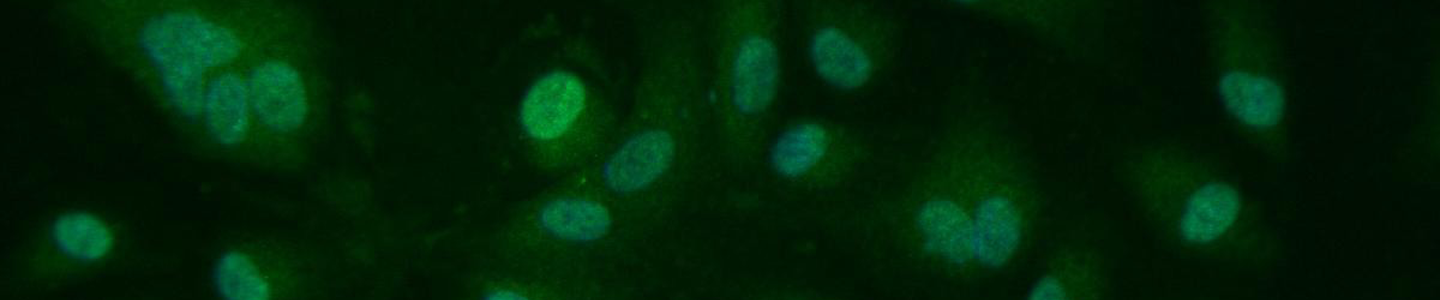 Green human umbilical vein endothelial cells.