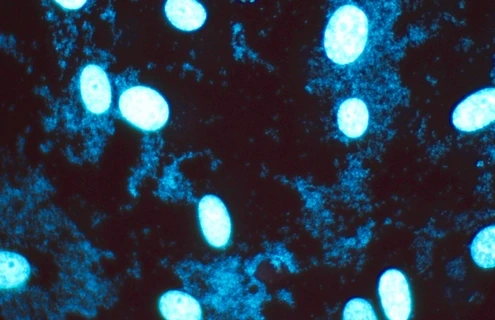 Blue m-hyorhinis mycoplasma cells.