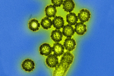 Colorized transmission electron micrograph showing multiple H1N1 influenza virus particles clustered around the surface of an infected cell. The spherical virions appear yellow-green with distinct outer envelopes and are surrounded by a blue background. Several individual virus particles are visible adjacent to a larger cellular structure from which the virions appear to be budding.