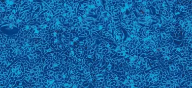 Small, fluorescent blue and white prostate cells.