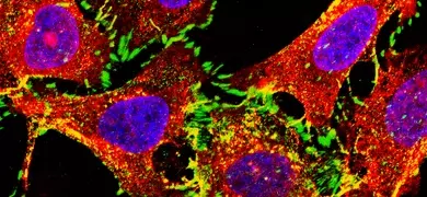 Red, purple, green, and yellow A549 CRISPR cells