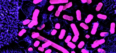 Fluorescent pink, rod-shaped Escherichia coli bacteria.