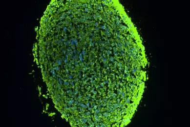 Fluorescence microscopy image showing a large, oval‑shaped three‑dimensional cell spheroid against a black background. The structure is densely packed, with bright green fluorescent signal outlining the outer region and a granular interior containing scattered blue‑stained nuclei. The image highlights the overall size, shape, and layered cellular organization within the multicellular aggregate.