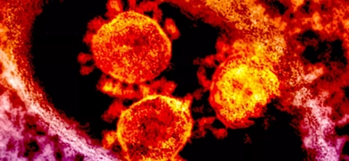 Grainy, red-orange and purple spheres of Middle East respiratory syndrome coronavirus.