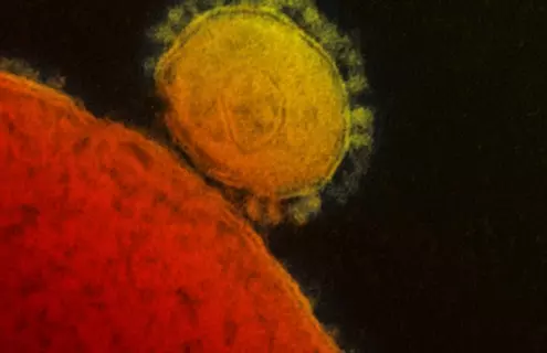 Grainy, large red and yellow spheres of Middle East respiratory syndrome coronavirus.