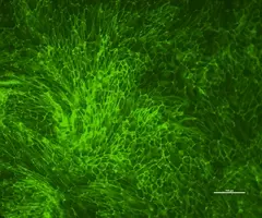 Green hTERT renal proximal tubular epithelial cells