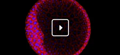 A microscopic image of organoid cells stained in red and blue. The left side shows more blue-stained cells, while the right side has a mix of red and blue-stained cells, with "CDX2" and "ECAD" labels in the top left corner.