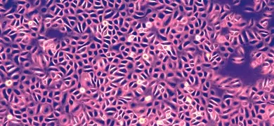 Cluster of small, fluorescent pink and black primary keratinocyte cells.