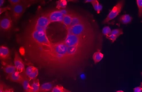 Blue and red mcf-7 human breast cells.