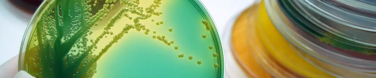 Microbiology, bacterial culture plates
