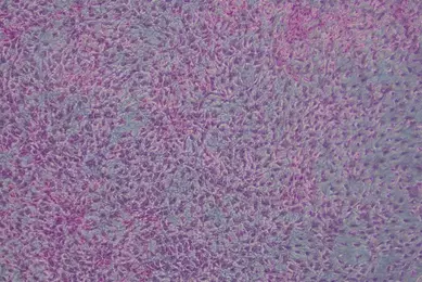 NIH3T3.2_typical monolayer, no foci_Stained_Day21.jpg