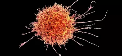 A highly magnified view of a natural killer (NK) cell. The NK cell appears as an irregular, spherical mass with numerous protruding extensions. The cell is colored in shades of orange and red, set against a black background.
