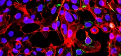 Purple and red HTB-9 B-Catenin monolayer cells.