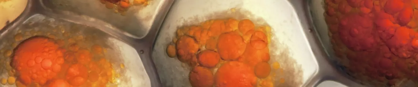A color‑enhanced microscopic image shows tightly packed fat cells filled with clusters of orange and yellow lipid droplets. The polygon-shaped adipocytes appear swollen as the droplets occupy most of the internal space.