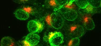 Fluorescent microscopy image showing a cluster of activated white blood cells, with green areas indicating MHC class II molecules on cell surfaces and red areas inside the cells representing cytokine synthesis.