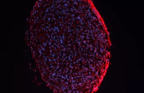 Neural Progenitor Cell-derived Neurosphere