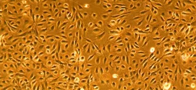 Microscopic image showing a dense layer of elongated, spindle-shaped cells with prominent nuclei, stained in orange and brown tones, arranged in a uniform pattern.