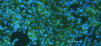 Fluorescent microscopy image of renal proximal tubular epithelial cells showing green-stained cytoskeletal structures and blue-stained nuclei, highlighting cell morphology and arrangement.