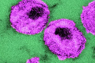 PHIL_10860 - HIV_Dr. A Harrison and Dr. P Feorino_CDC.tif