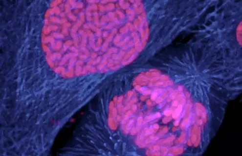 Human Breast Cancer cell dividing.jpg